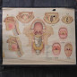 Medical engraving (various models)